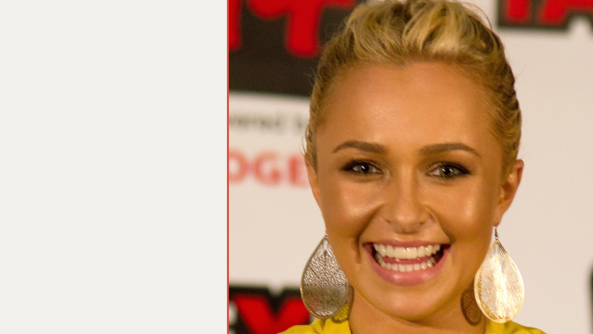 Hayden Panettiere Dies at 36: What Her Neutrogena Fallout Reveals About Beauty Contract Law